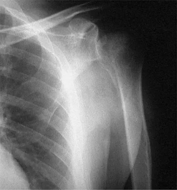 Upper Extremity Board Review 2008: High-Yield MCQs (Set 2) - Figure 23