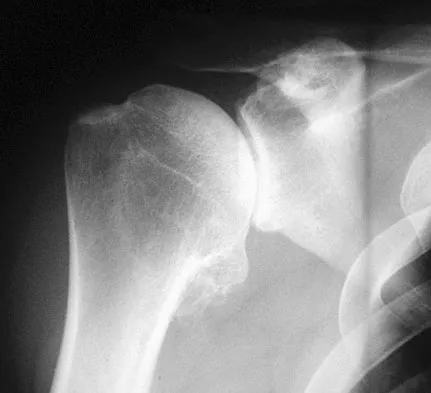 Upper Extremity Board Review 2008: High-Yield MCQs (Set 2) - Figure 27