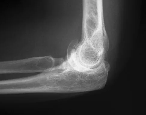 Upper Extremity Board Review 2008: High-Yield MCQs (Set 2) - Figure 5