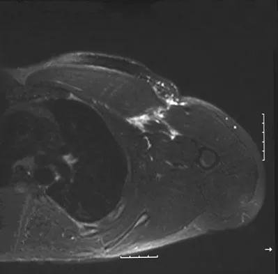 Upper Extremity Board Review 2008: High-Yield MCQs (Set 2) - Figure 8