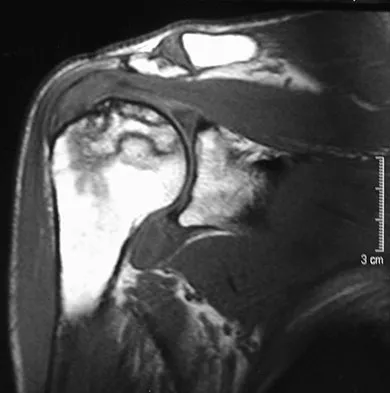 Upper Extremity 2008 Practice Questions: Set 3 (Solved) - Figure 17