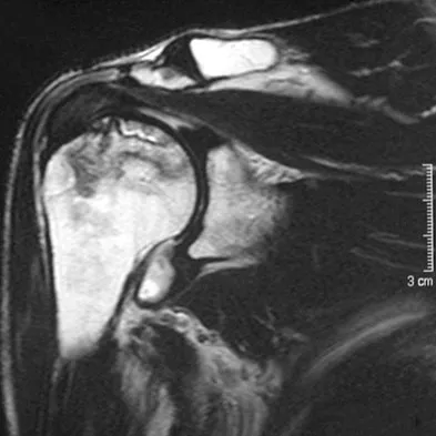 Upper Extremity 2008 Practice Questions: Set 3 (Solved) - Figure 18