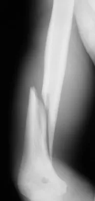 Upper Extremity 2008 Practice Questions: Set 3 (Solved) - Figure 3