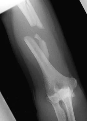 Upper Extremity 2008 Practice Questions: Set 3 (Solved) - Figure 5