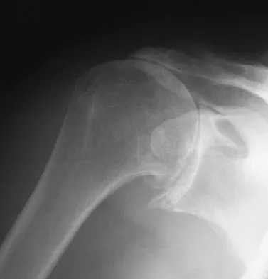 Upper Extremity 2008 Practice Questions: Set 3 (Solved) - Figure 9