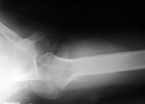 Upper Extremity Board Review 2008: High-Yield MCQs (Set 4) - Figure 11