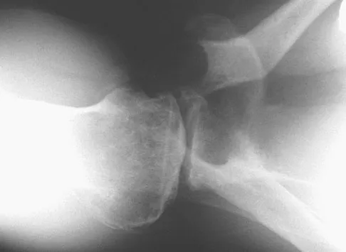 Upper Extremity Board Review 2008: High-Yield MCQs (Set 4) - Figure 19