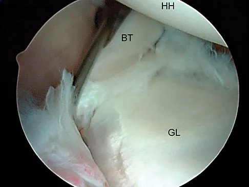 Upper Extremity Board Review 2008: High-Yield MCQs (Set 4) - Figure 20