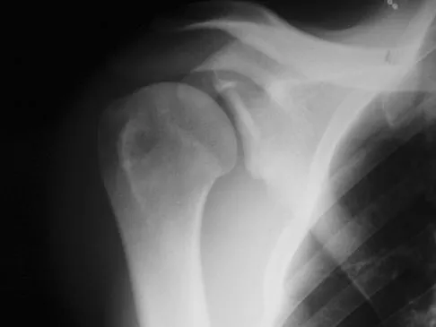 Upper Extremity Board Review 2008: High-Yield MCQs (Set 4) - Figure 4