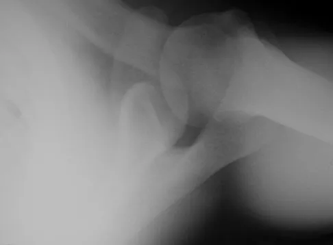 Upper Extremity Board Review 2008: High-Yield MCQs (Set 4) - Figure 5