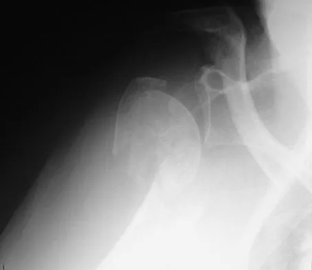 Upper Extremity Board Review 2008: High-Yield MCQs (Set 4) - Figure 8