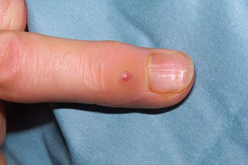 Upper Extremity 2008 Practice Questions: Set 5 (Solved) - Figure 11