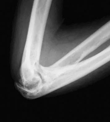 Upper Extremity 2008 Practice Questions: Set 5 (Solved) - Figure 13