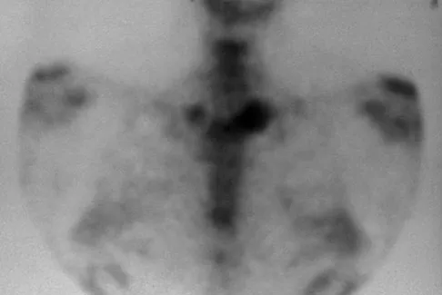 Upper Extremity 2008 Practice Questions: Set 5 (Solved) - Figure 16