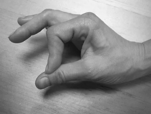 Upper Extremity 2026 MCQs: Board Review Questions & Answers (Part 1) - Figure 103