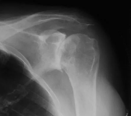 Upper Extremity 2026 MCQs: Board Review Questions & Answers (Part 1) - Figure 115