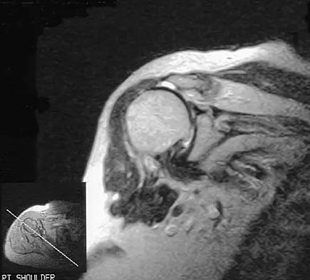 Upper Extremity 2026 MCQs: Board Review Questions & Answers (Part 1) - Figure 23