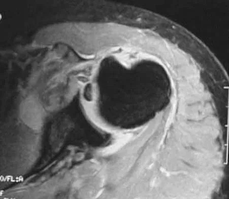 Upper Extremity 2026 MCQs: Board Review Questions & Answers (Part 1) - Figure 29