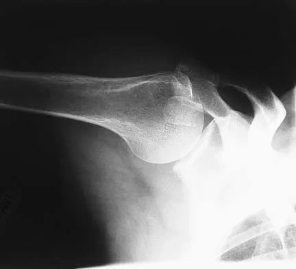 Upper Extremity 2026 MCQs: Board Review Questions & Answers (Part 1) - Figure 3