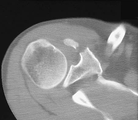 Upper Extremity 2026 MCQs: Board Review Questions & Answers (Part 1) - Figure 5