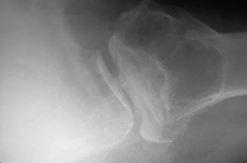 Upper Extremity 2026 MCQs: Board Review Questions & Answers (Part 1) - Figure 75