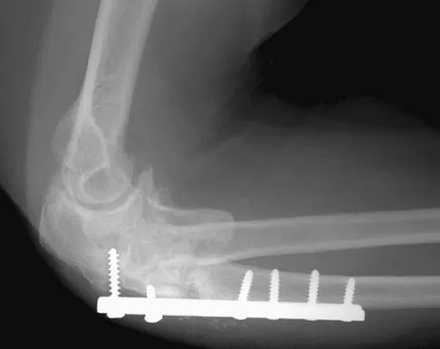 Upper Extremity 2026 MCQs: Board Review Questions & Answers (Part 1) - Figure 89