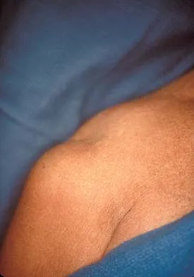 Upper Extremity 2026 MCQs: Board Review Questions & Answers (Part 1) - Figure 99