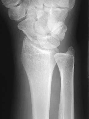 Upper Extremity 2026 MCQs: Board Review Questions & Answers (Part 2) - Figure 101