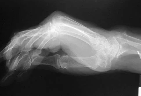 Upper Extremity 2026 MCQs: Board Review Questions & Answers (Part 2) - Figure 107