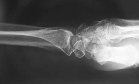 Upper Extremity 2026 MCQs: Board Review Questions & Answers (Part 2) - Figure 123