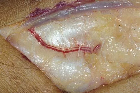 Upper Extremity 2026 MCQs: Board Review Questions & Answers (Part 2) - Figure 137