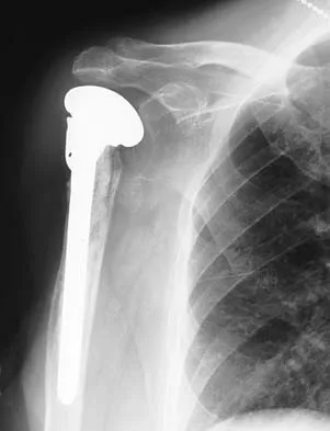 Upper Extremity 2026 MCQs: Board Review Questions & Answers (Part 2) - Figure 21