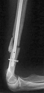 Upper Extremity 2026 MCQs: Board Review Questions & Answers (Part 2) - Figure 5