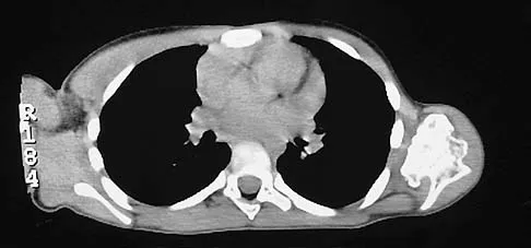 Upper Extremity 2026 MCQs: Board Review Questions & Answers (Part 2) - Figure 61