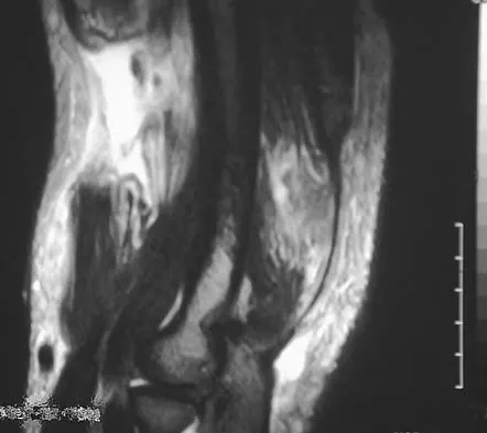 Upper Extremity 2026 MCQs: Board Review Questions & Answers (Part 2) - Figure 65