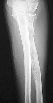 Upper Extremity 2026 MCQs: Board Review Questions & Answers (Part 2) - Figure 67