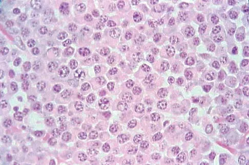 Upper Extremity 2026 MCQs: Board Review Questions & Answers (Part 2) - Figure 71