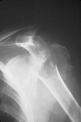 Upper Extremity 2026 MCQs: Board Review Questions & Answers (Part 2) - Figure 73