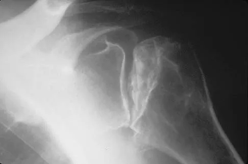 Upper Extremity 2026 MCQs: Board Review Questions & Answers (Part 2) - Figure 77