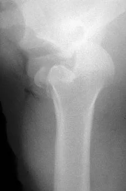 Upper Extremity 2026 MCQs: Board Review Questions & Answers (Part 2) - Figure 9