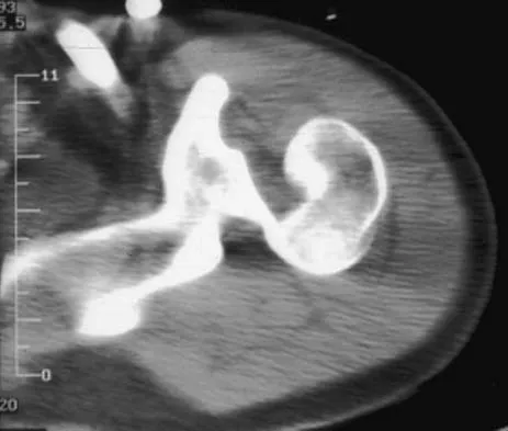 Upper Extremity 2026 MCQs: Board Review Questions & Answers (Part 3) - Figure 15