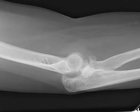 Upper Extremity 2026 MCQs: Board Review Questions & Answers (Part 3) - Figure 17