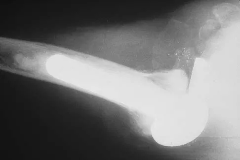 Upper Extremity 2026 MCQs: Board Review Questions & Answers (Part 3) - Figure 29