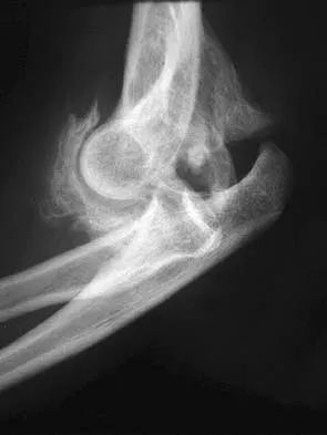 Upper Extremity 2026 MCQs: Board Review Questions & Answers (Part 3) - Figure 3