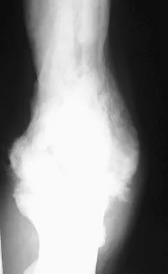 Upper Extremity 2026 MCQs: Board Review Questions & Answers (Part 3) - Figure 35