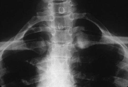 Upper Extremity 2026 MCQs: Board Review Questions & Answers (Part 3) - Figure 39