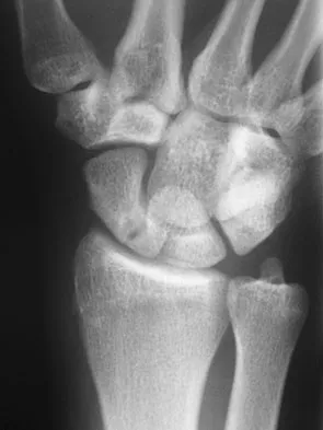 Upper Extremity 2026 MCQs: Board Review Questions & Answers (Part 3) - Figure 43