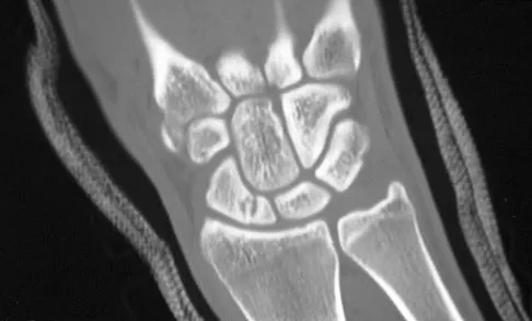 Upper Extremity 2026 MCQs: Board Review Questions & Answers (Part 3) - Figure 45