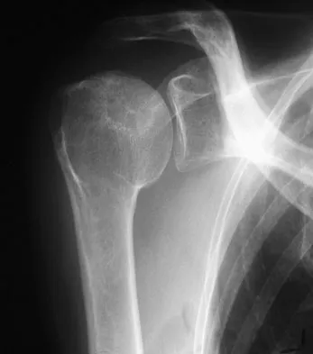 Upper Extremity 2026 MCQs: Board Review Questions & Answers (Part 3) - Figure 47