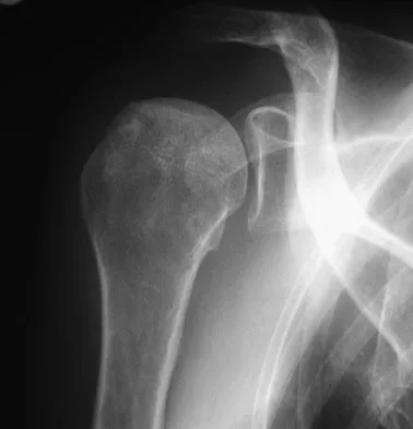 Upper Extremity 2026 MCQs: Board Review Questions & Answers (Part 3) - Figure 49